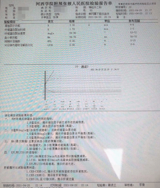 饮用水过滤棉用哪种比较好