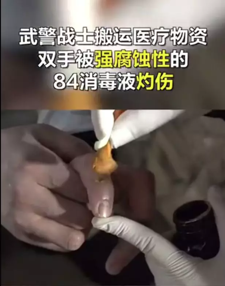 防护手套有什么用